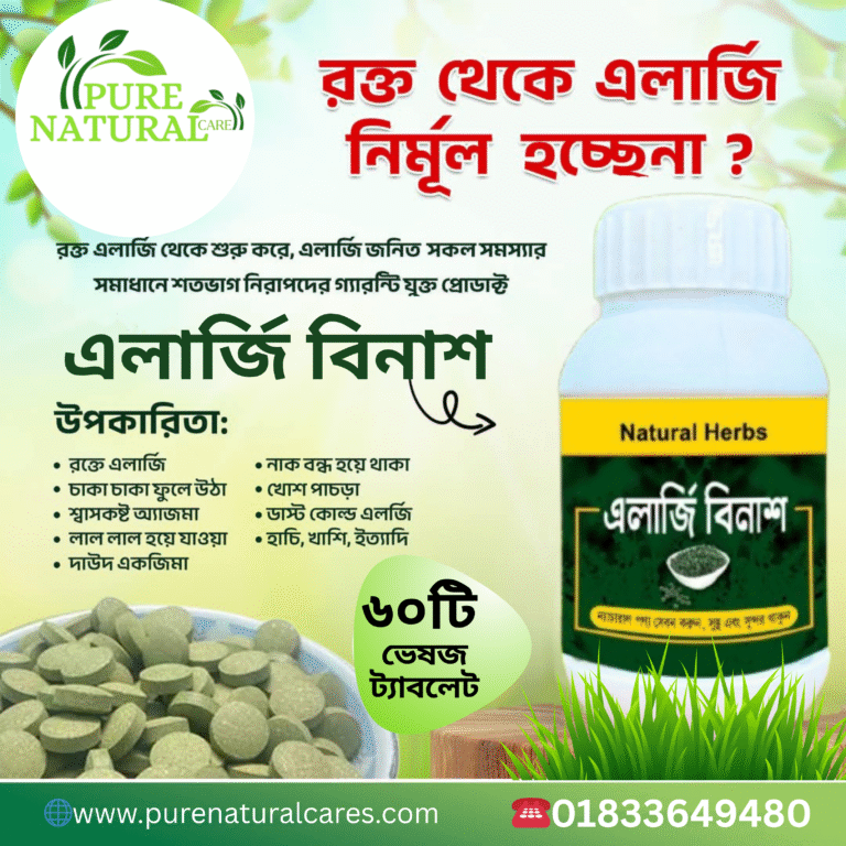 এলার্জি বিনাশ - Natural Solution
